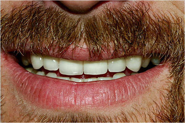 Advanced Care Dental Advanced Care Dental