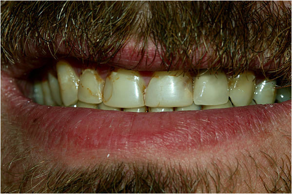 Advanced Care Dental Advanced Care Dental