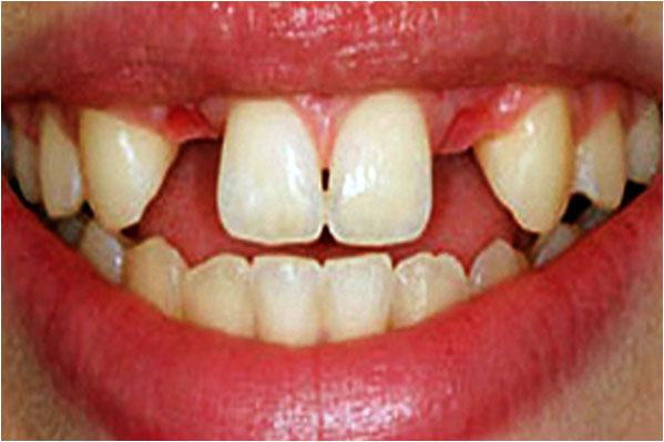 Advanced Care Dental Advanced Care Dental