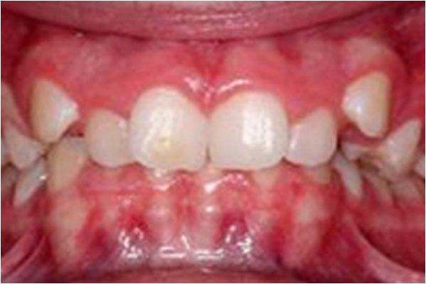 Advanced Care Dental Advanced Care Dental