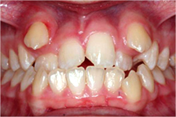 Advanced Care Dental Advanced Care Dental