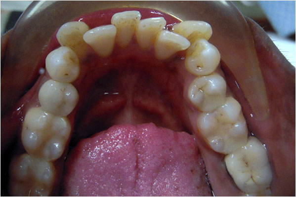 Advanced Care Dental Advanced Care Dental